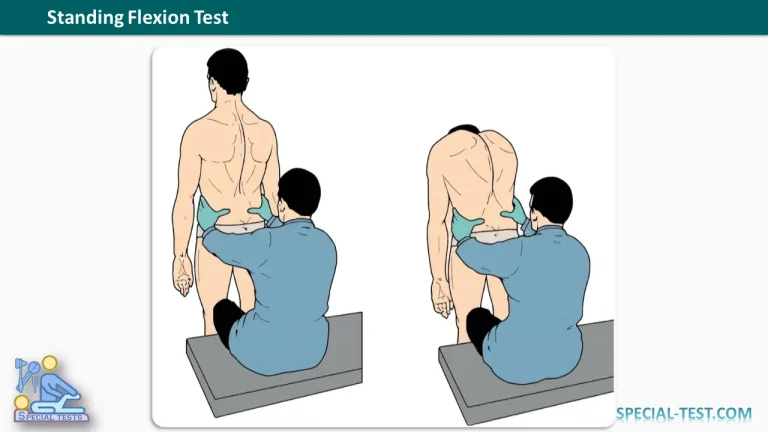 Standing Flexion Test