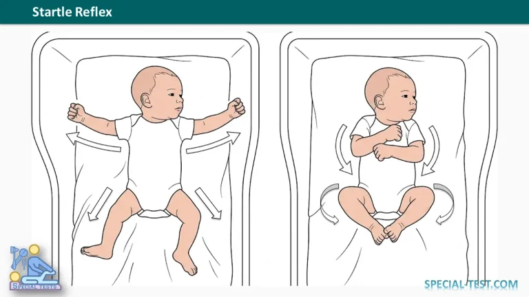 Startle Reflex