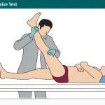 Straight Leg Raise Test – Lasegue Test