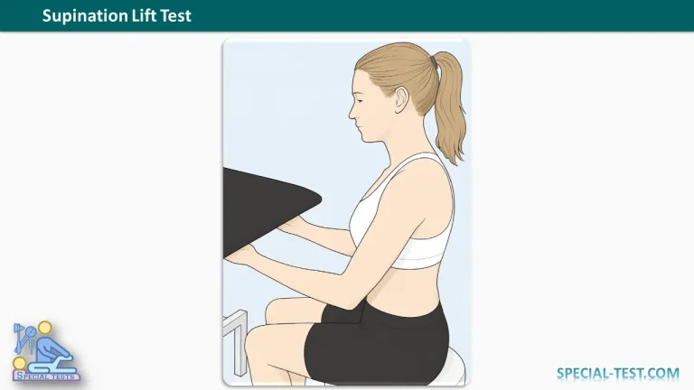 Supination Lift Test