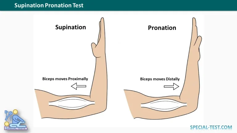 Supination Pronation Test