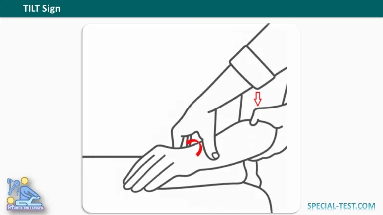 TILT Sign