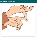 Tethered Median Nerve Stress Test