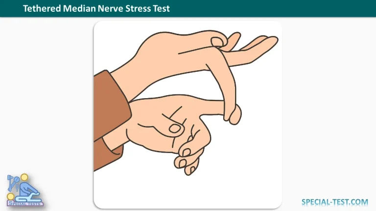 Tethered Median Nerve Stress Test