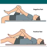 Thomas Test