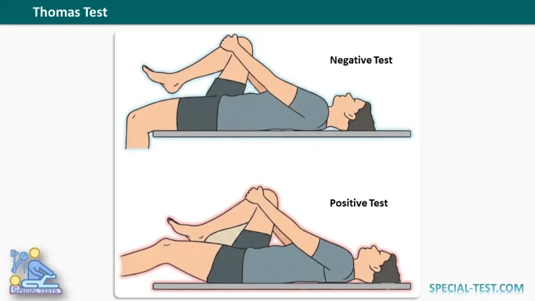 Thomas Test