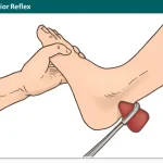 Tibialis Posterior Reflex