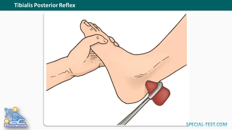 Tibialis Posterior Reflex