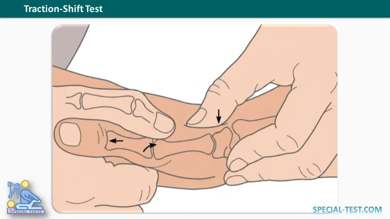 Traction Shift Test