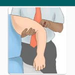 Triceps Reflex
