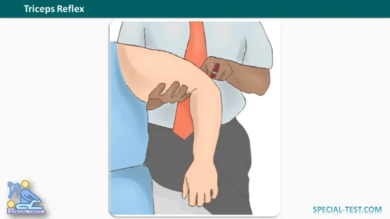 Triceps Reflex