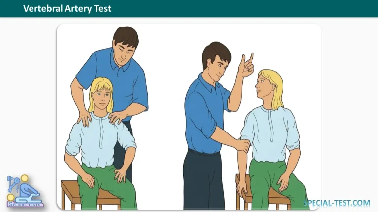 Vertebral Artery Test