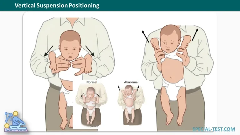 Vertical Suspension Positioning
