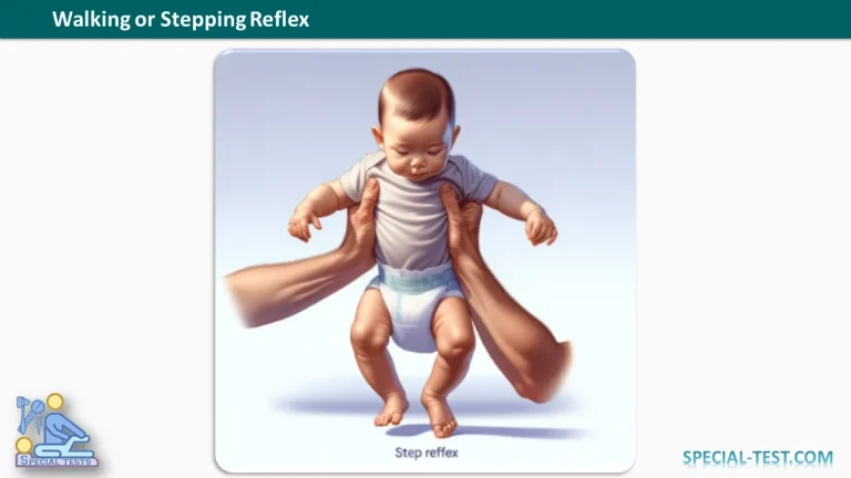 Walking or Stepping Reflex