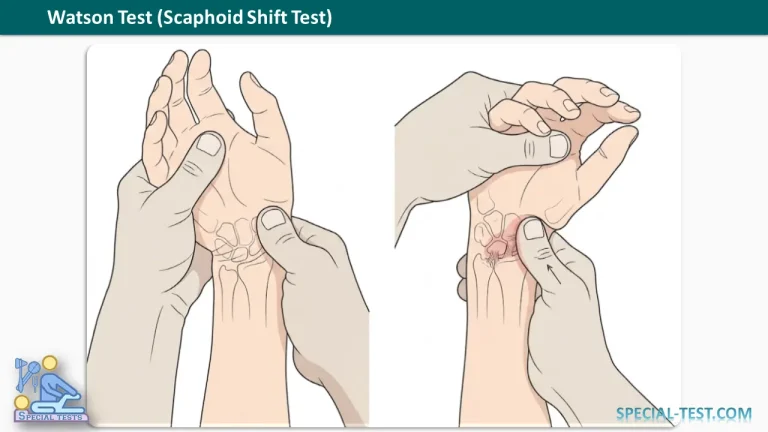 Watson Test Scaphoid Shift Test