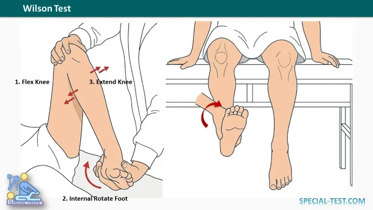 Wilson Test