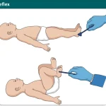 Withdrawal Reflex