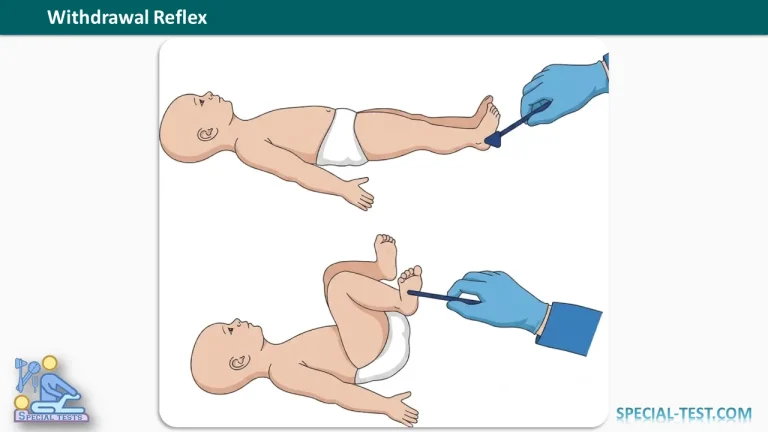 Withdrawal Reflex