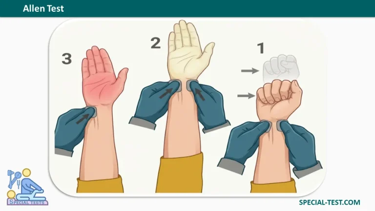 allen test