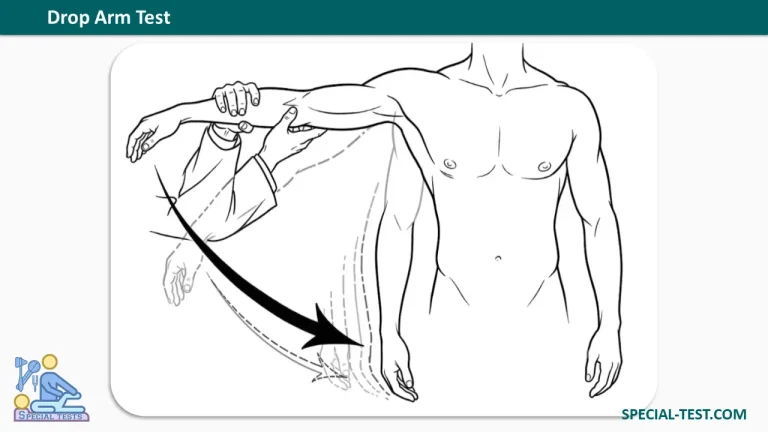 drop arm test