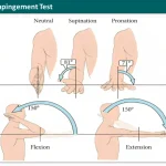 elbow rom