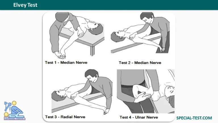 elvey test