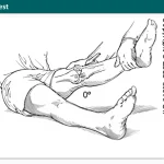 knee valgus test