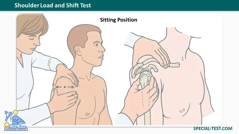 shoulder load and shift test sitting