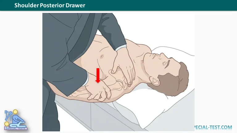 shoulder posterior drawer