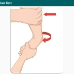 syndesmotic ligaments External Rotation Test