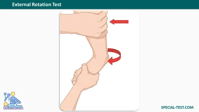 syndesmotic ligaments External Rotation Test